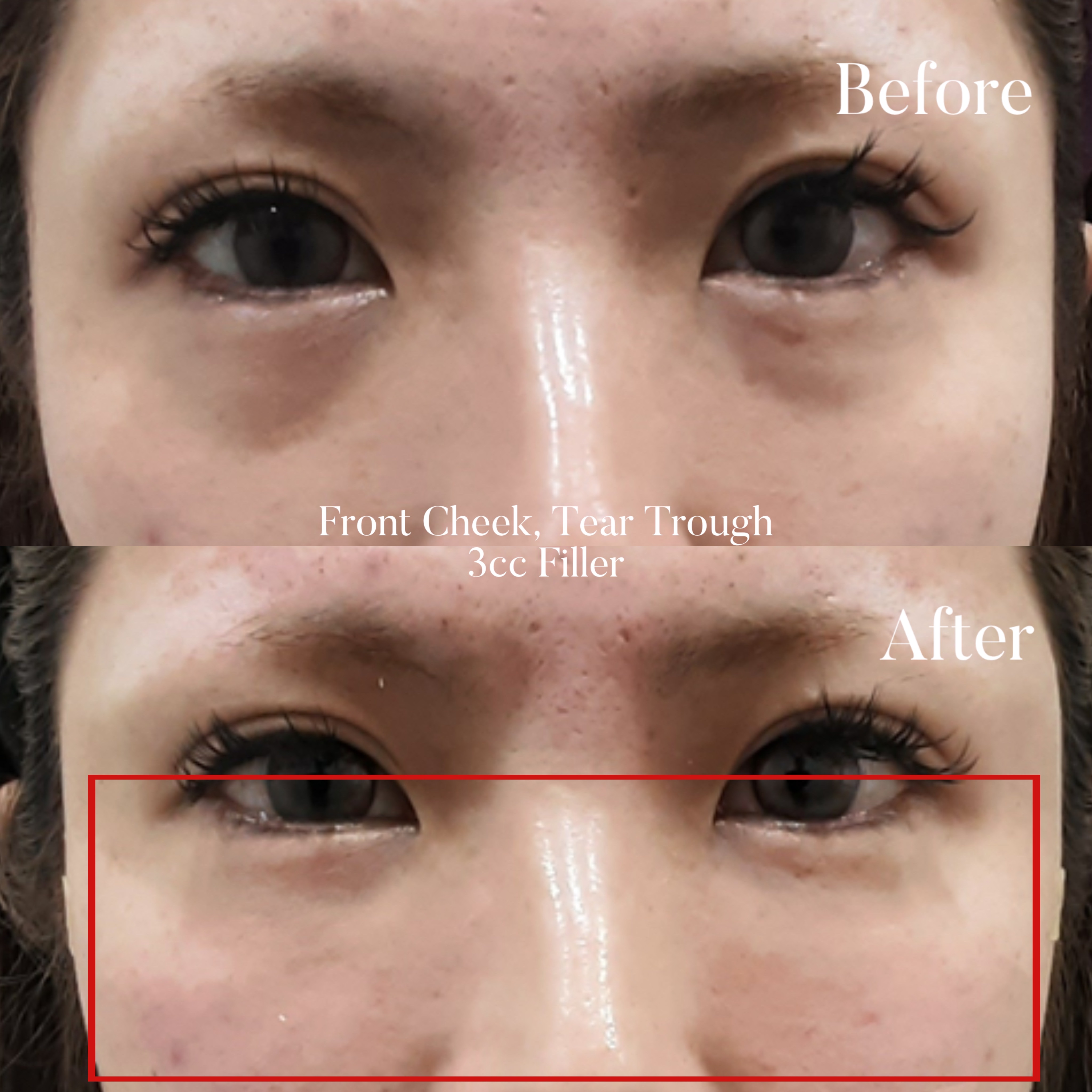 Volumetric Restoration