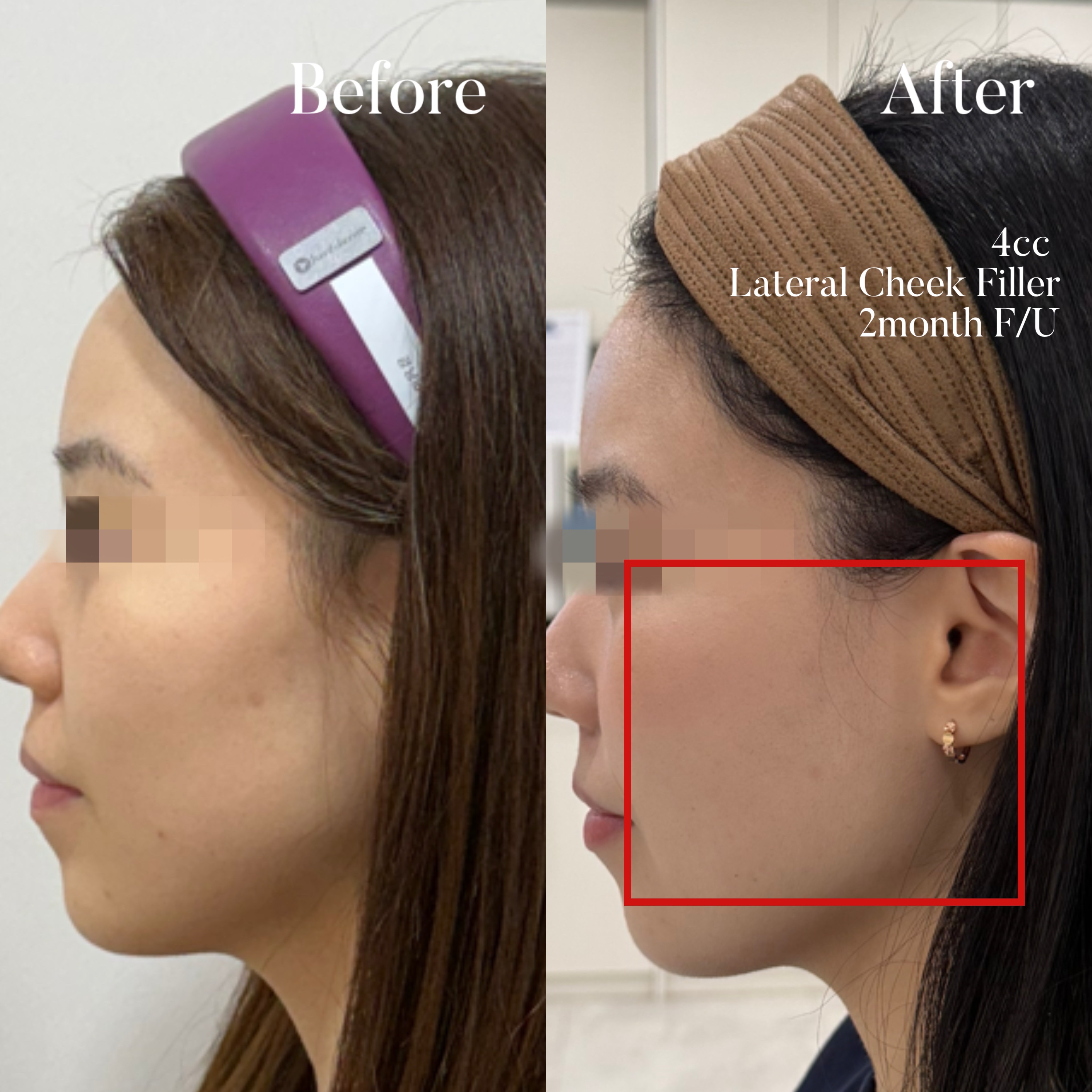 Volumetric Restoration