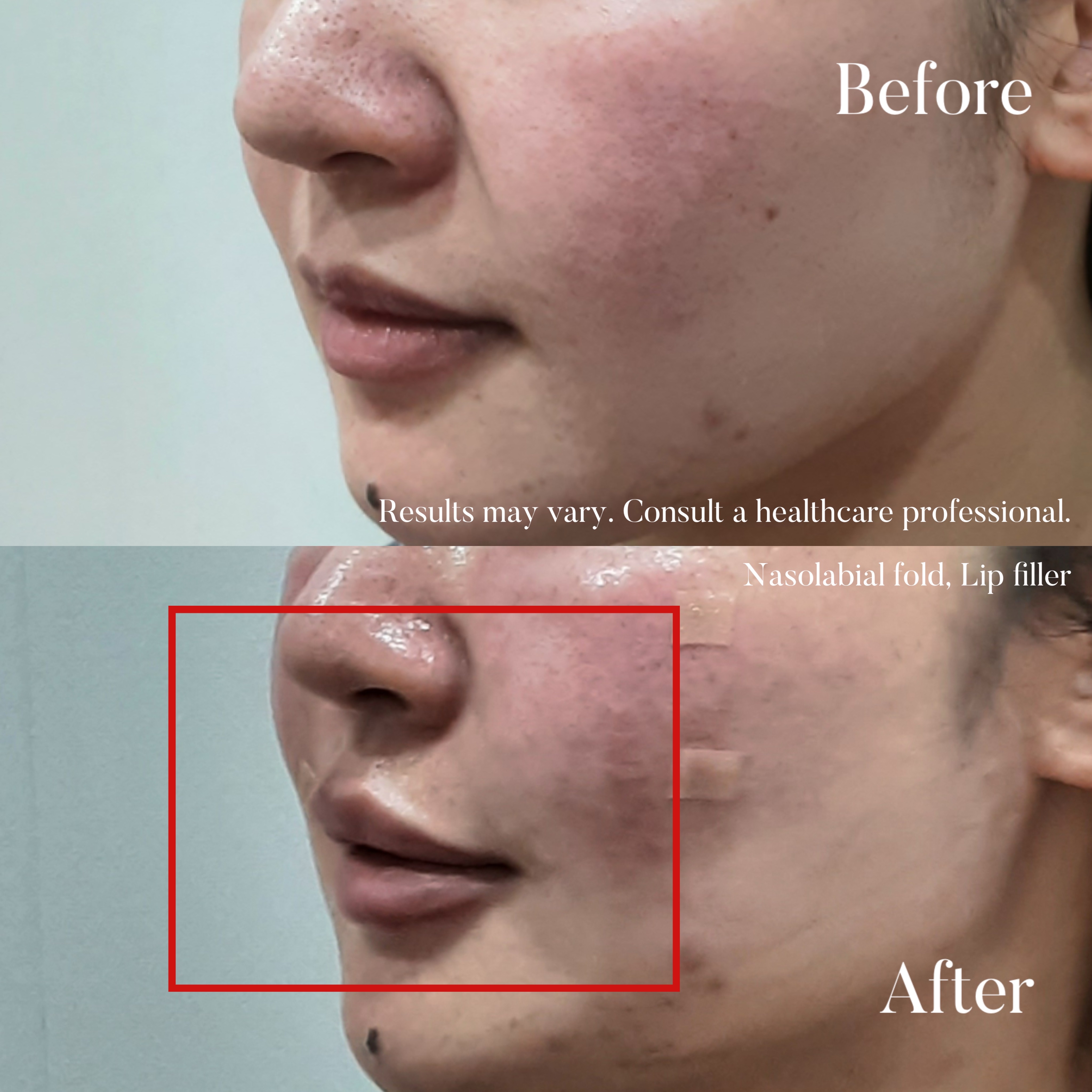 Volumetric Restoration