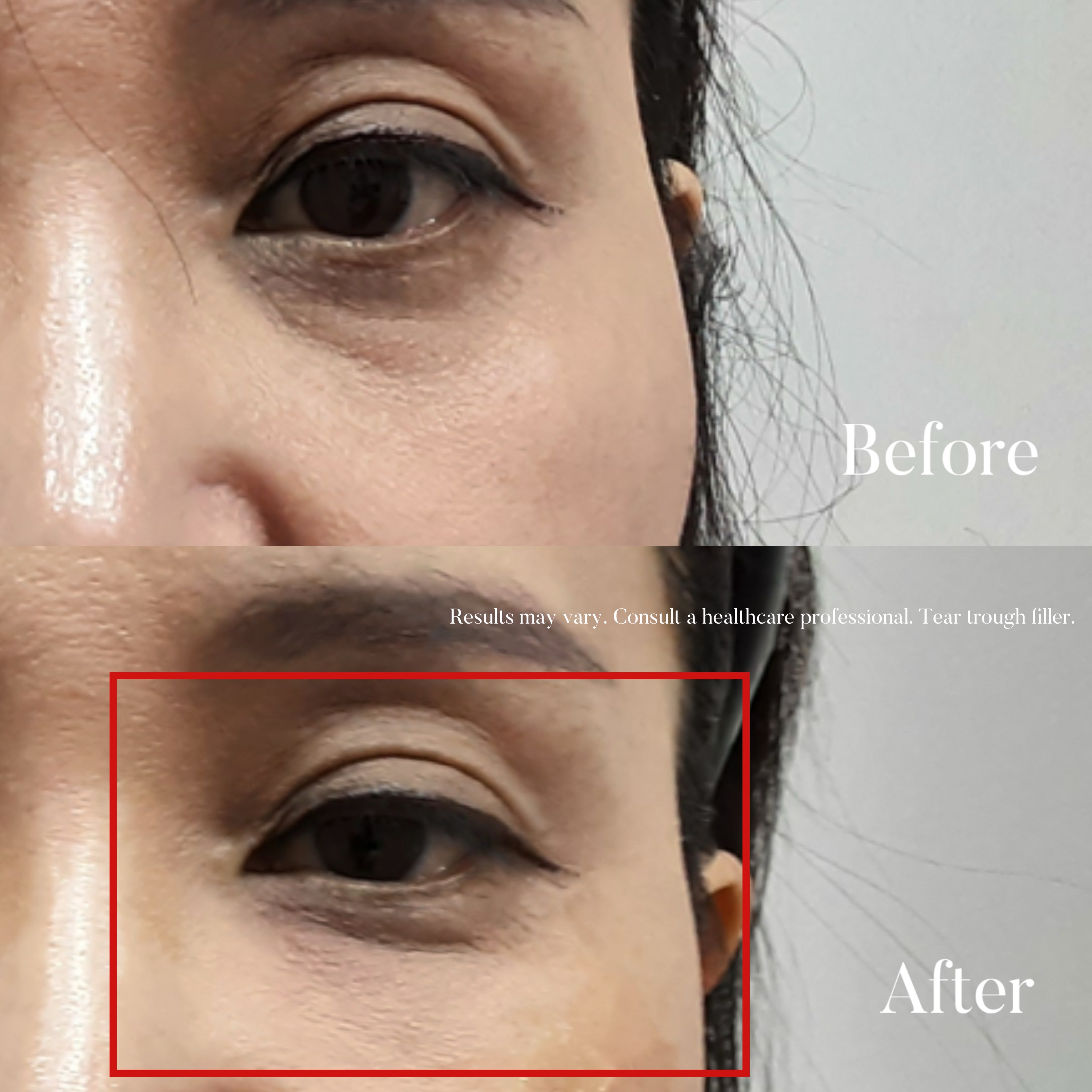 Volumetric Restoration