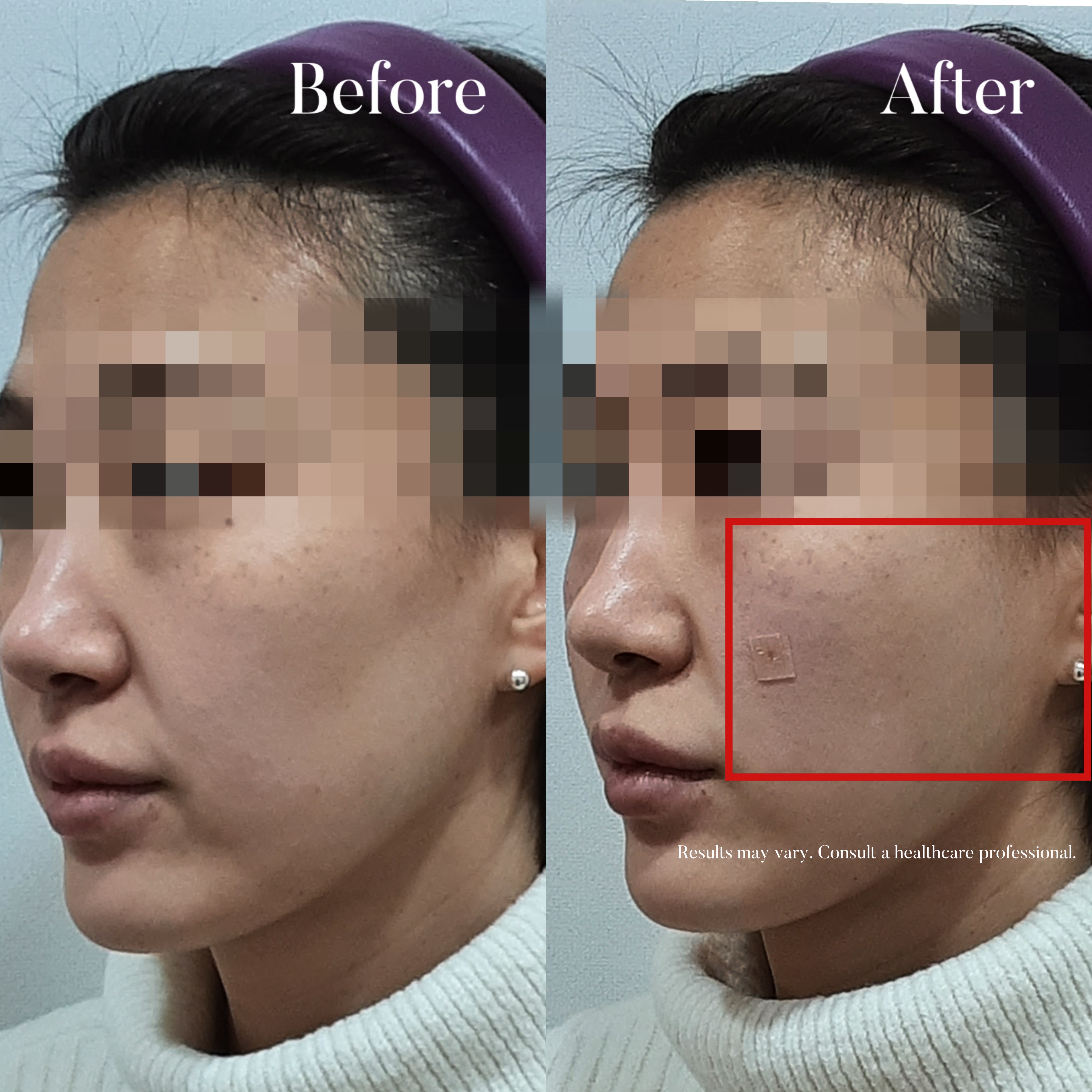 Volumetric Restoration