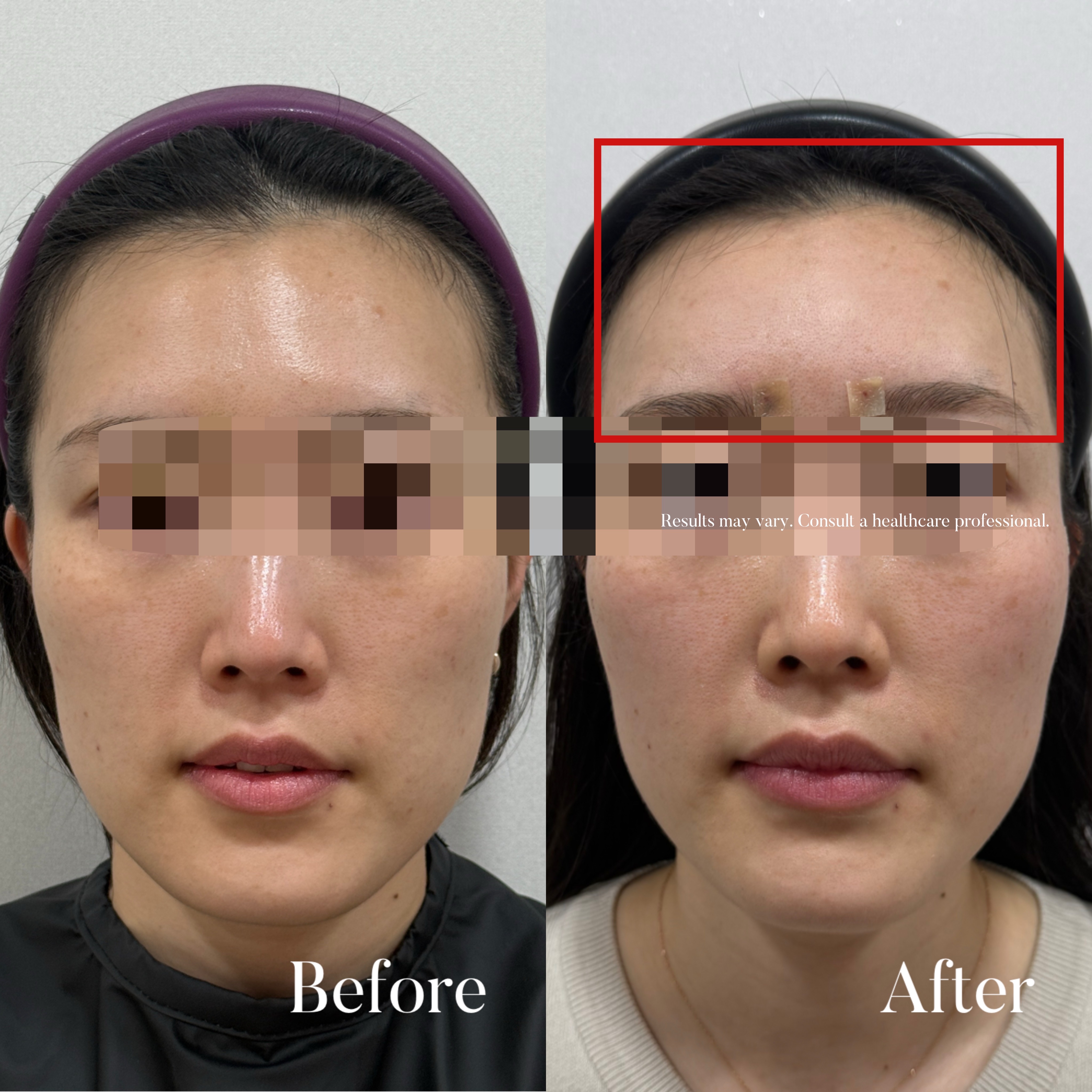 Volumetric Restoration