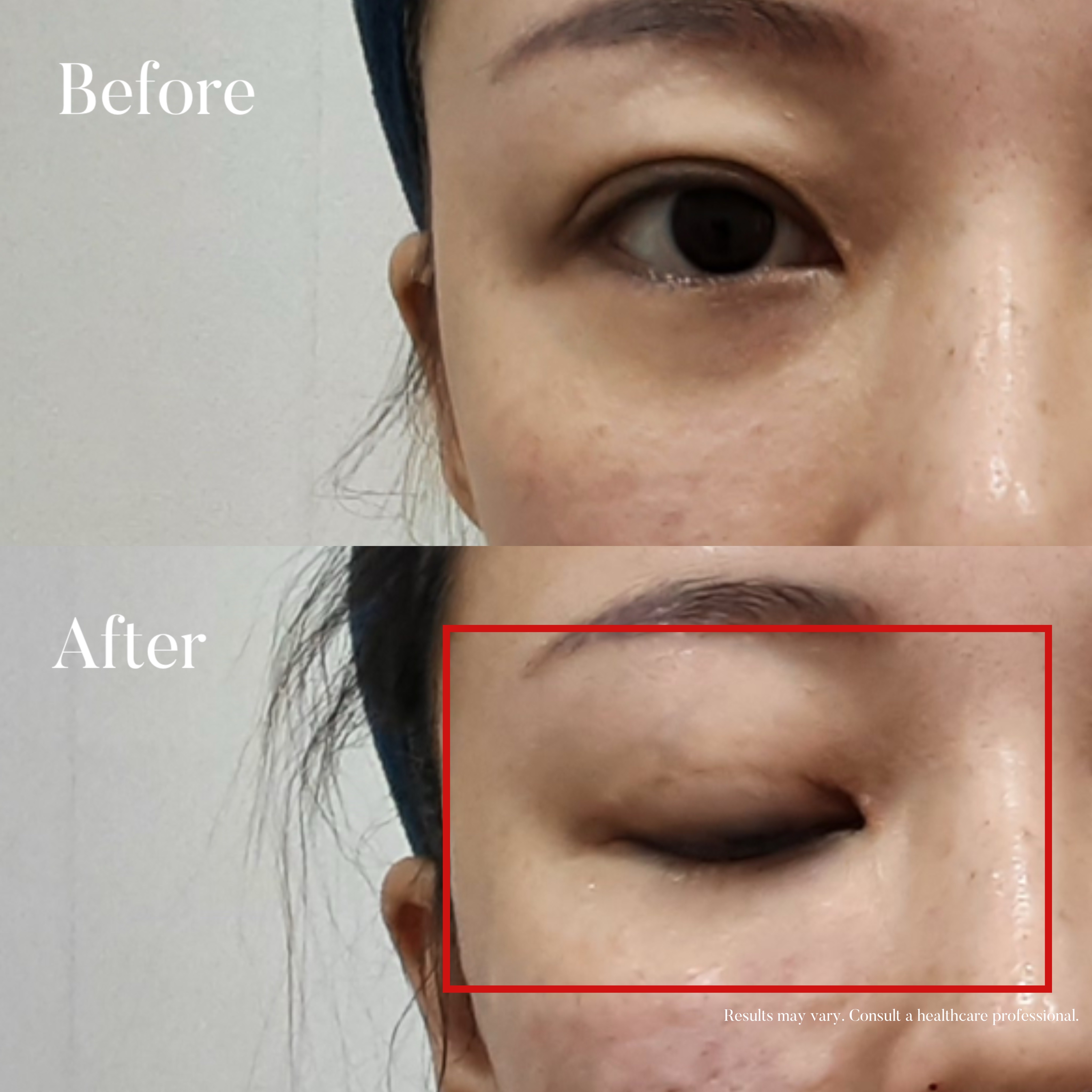 Volumetric Restoration