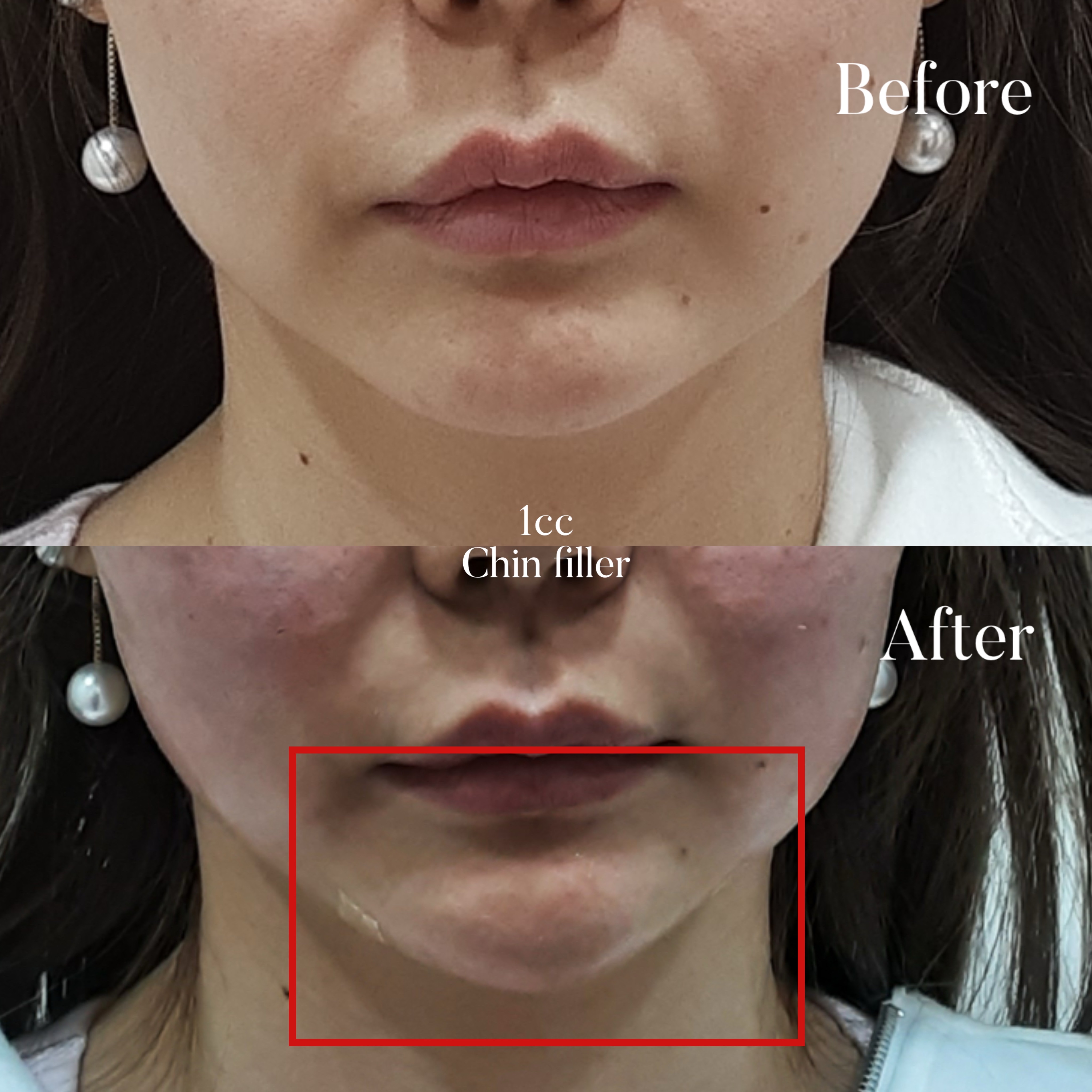 Volumetric Restoration